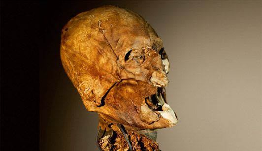 La tête au carré / la tête d'Henri IV