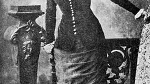Hypnose produite par un diapason - 1899