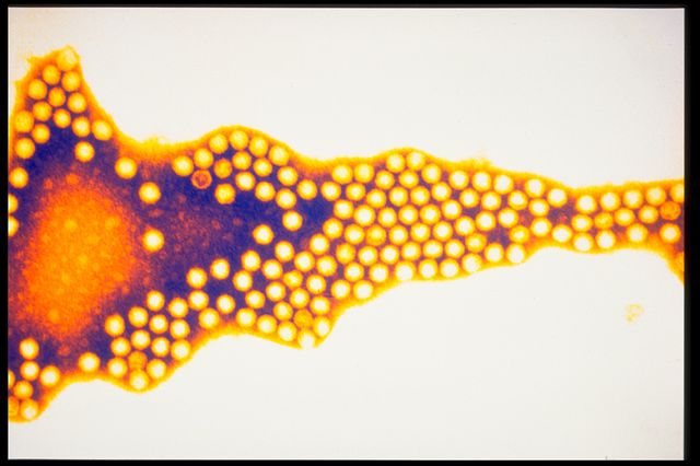 Polio virus (Picornavirus)