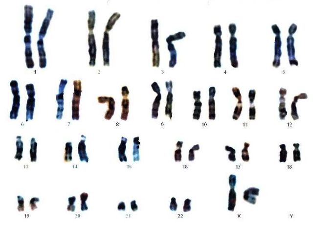 Caryotype (Mapa genético o cariograma)