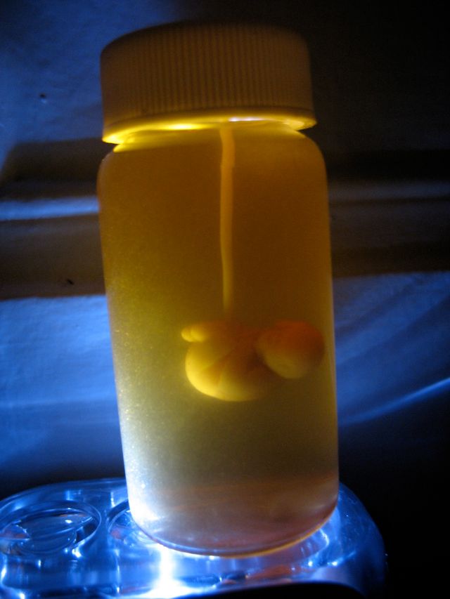 Foetus dans un tube à essai (Test Tube Baby)