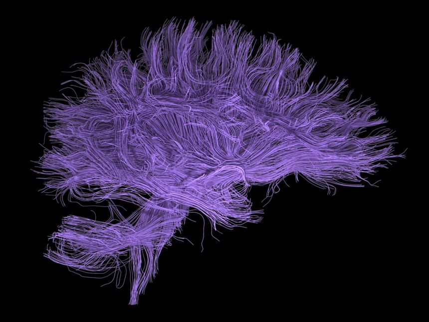 cerveau vue d'artiste