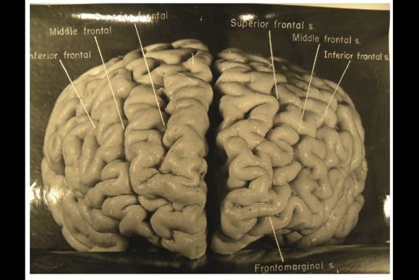 Le cerveau d'Einstein