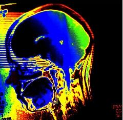 cerveau