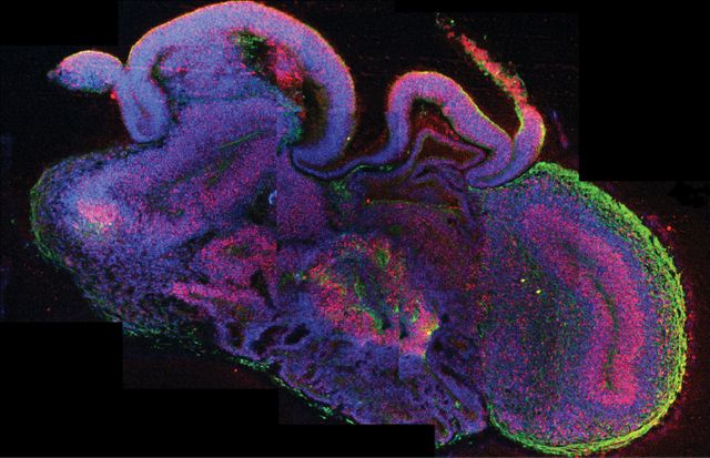 Mini-cerveau Australie 1