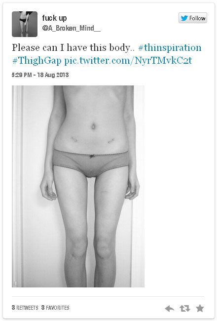 tweet thigh-gap