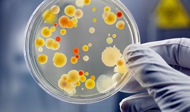 Microbes et virus