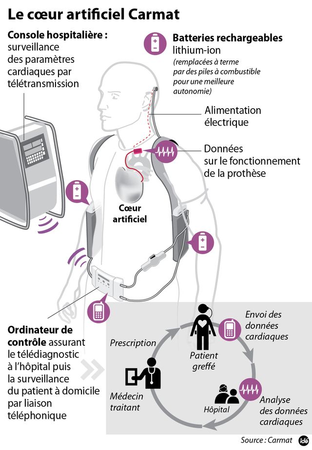Coeur artificiel Carmat