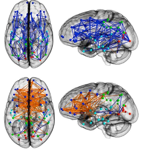 Connexions internes du cerveau de 428 hommes (en haut) et 521 femmes (en bas)
