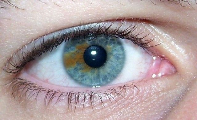 oeil