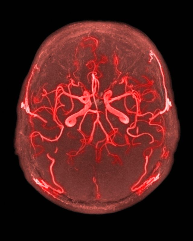 cerveau