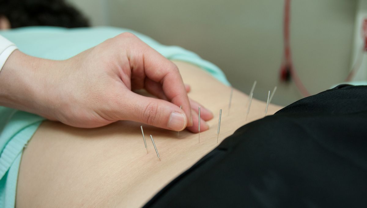 Hagetmau Une Acupunctrice Condamnee Pour Exercice Illegal De La Medecine