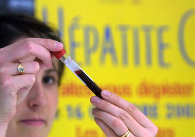 De nouveaux espoirs contre l'hépatite C