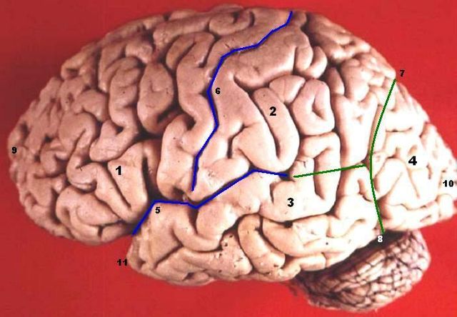 Un cerveau