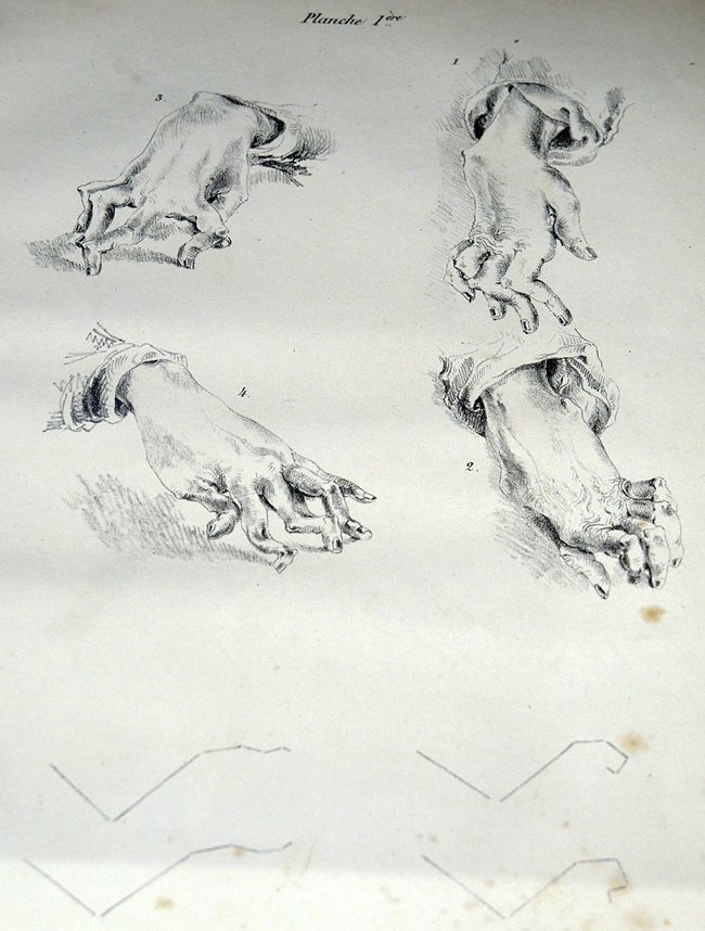 Feuillet préparatoire à la thèse de médecine, réalisé à l'encre par Charcot, 1853