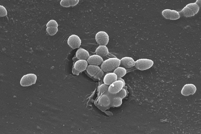 "Entérocoques", bactéries du tube digestif