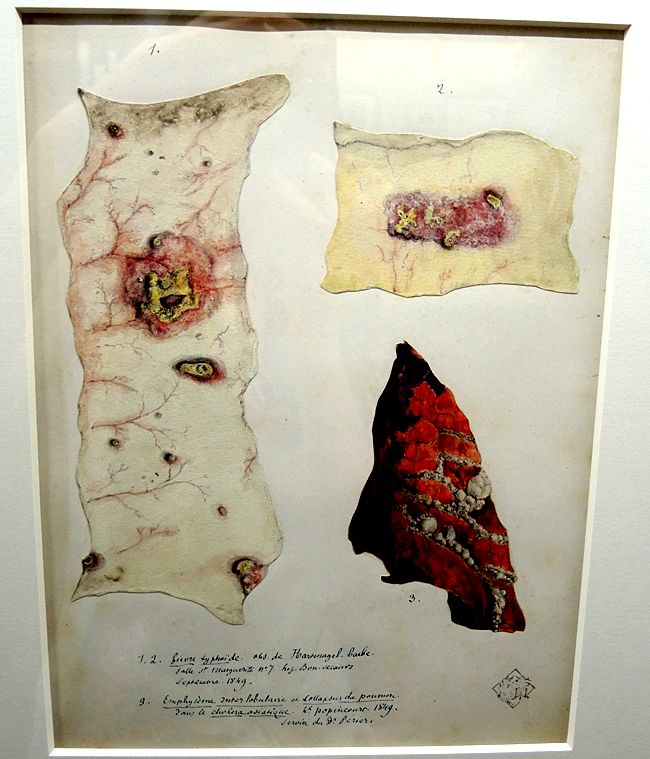 Planche d'album, par Charcot. Encre, aquarelle et crayon, 1849