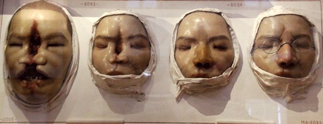 Moulage 2