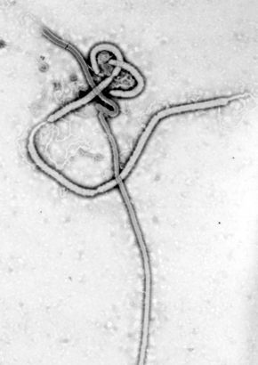 Image d'une partie du virus Ebola vue au microscope électronique.