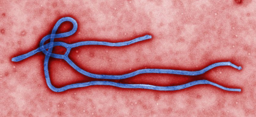 virus Ebola