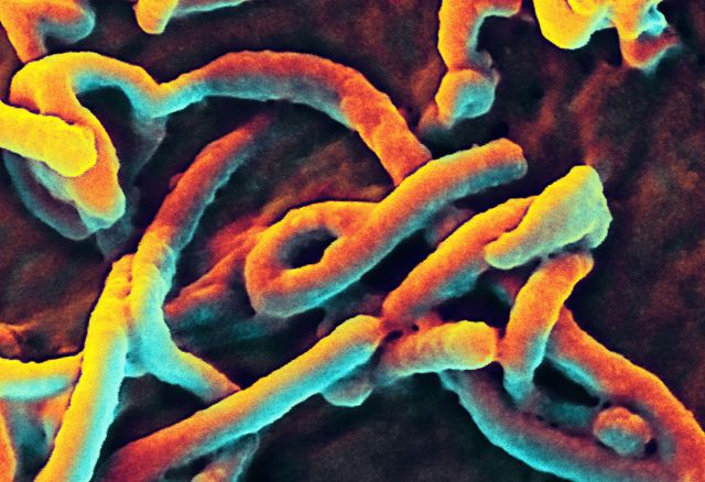 Le virus Ebola au microscope