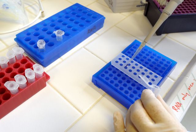 L'Inserm travaille maintenant au développement d'un test sanguin qui permettrait de détecter cette protéine bactérienne.