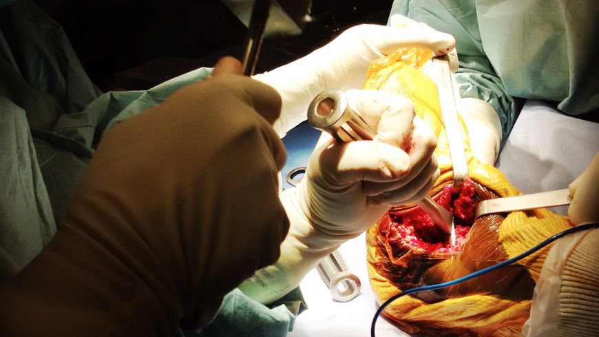 Chirurgie orthopédique