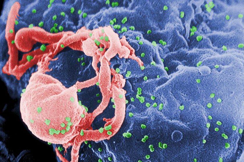 VIH (en vert) sur un lymphocyte