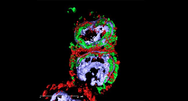 Virus de la grippe saisonnière Influenza A/H5N1