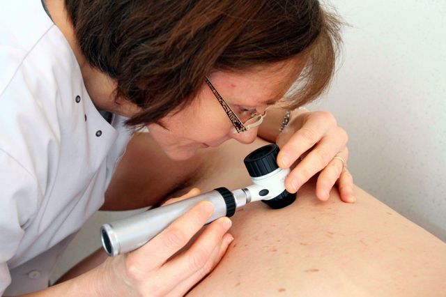 Dépistage des cancers de la peau