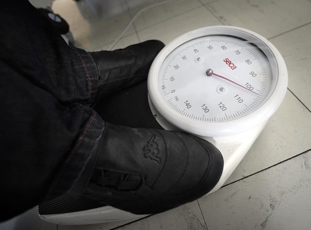 De plus en plus de Français ont recours à la chirurgie bariatrique.