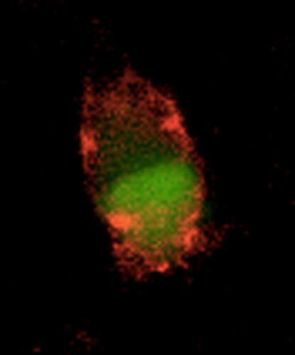 Cellule en culture ayant fixé des fibres d'alpha-synucléine