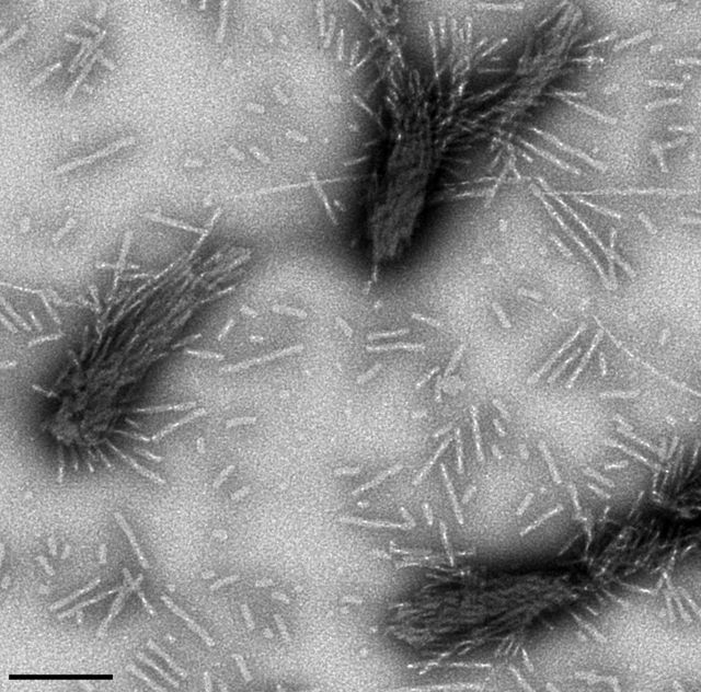 Amas d'alpha-synucléine fibrillaire