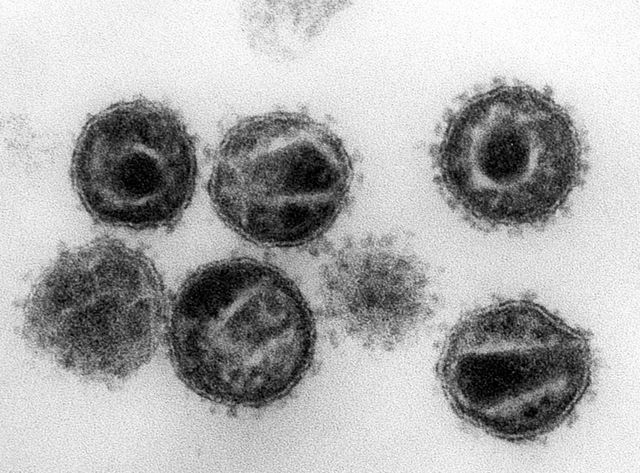 Le virus du VIH grossis 240.000 fois au moyen d'un microscope électronique