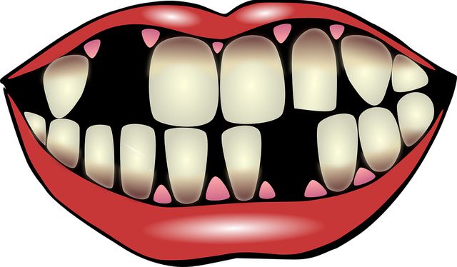Les dents