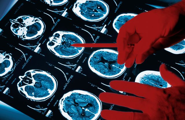 Neurologue examinant des scans de cerveau
