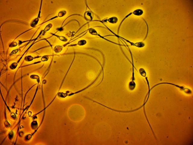 Spermatozoïdes-traumatismes-déséquilibres alimentaires