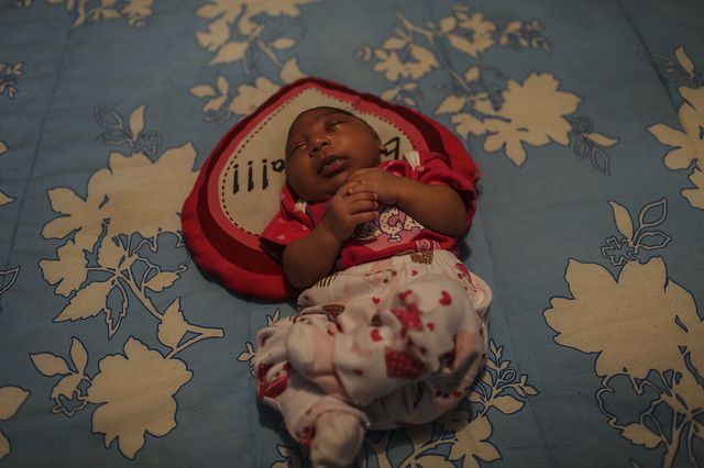 Zika vraiment responsable des microcéphalies?