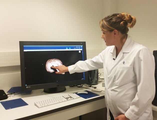 Analyse au scanner du crâne du squelette inconnu