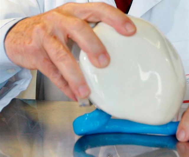 première implantation humaine du coeur artificiel de carmat