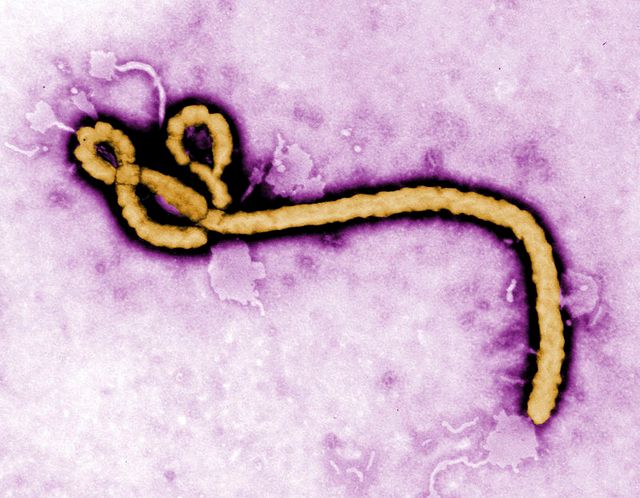 tests très prometteurs sur le singe du sérum zmapp contre ebola