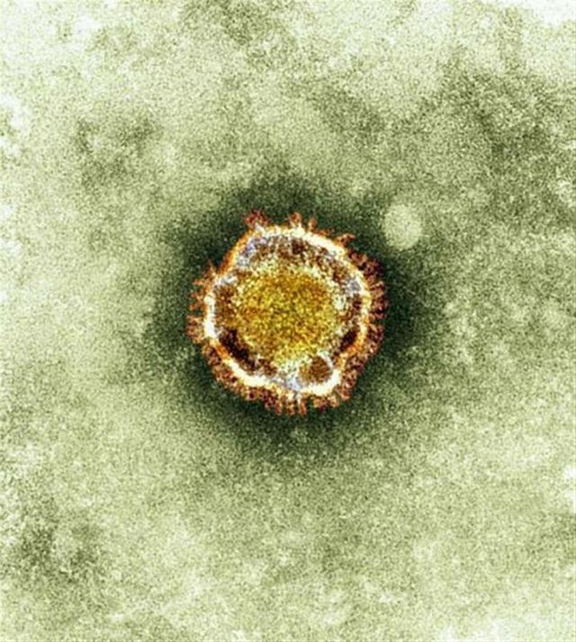 soupçons de virus proche du sras chez deux autres personnes
