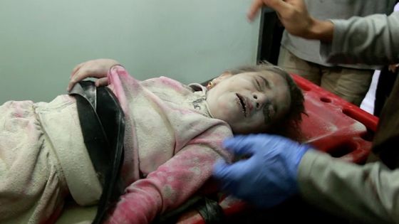 Fillette de 6 ans blessée après un bombardement aérien à Alep ©AFP - STRINGER / ANADOLU AGENCY