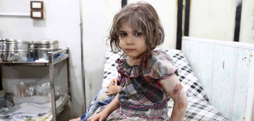 Enfant blessée attendant d'être prise en charge à l'hôpital de Douma en Syrie, après un bombardement aérien.