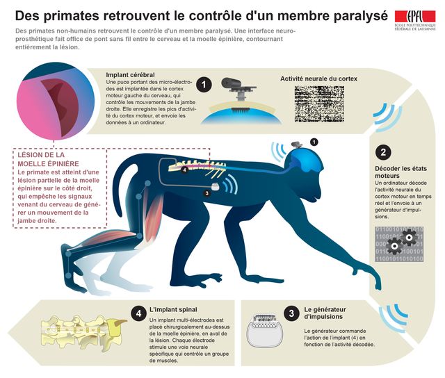 Explication du fonctionnement de ces neuroprothèses.