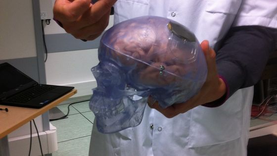Interface homme/machine Clinatec ©Radio France - Lydia Ben Ytzhak