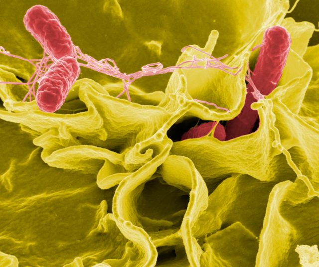 Salmonelle au microscope