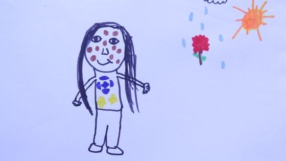 Loujaine se dessine - enfant atteinte d'un naevus congénital géant ©Radio France - Elise Andrieu
