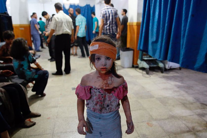 Jeune enfant recueillie dans un hôpital de Douma en août 2015, à l'est de Damas, après des attaques aériennes gouvernementales.