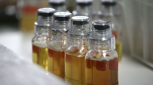 Echantillons d'urine pour un test anti-dopage